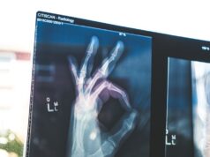 Waarom Italianen zo lang leven: het geheim achter hun gezondheid citiscan result hand ok